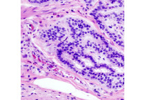 Rapid staining Kits